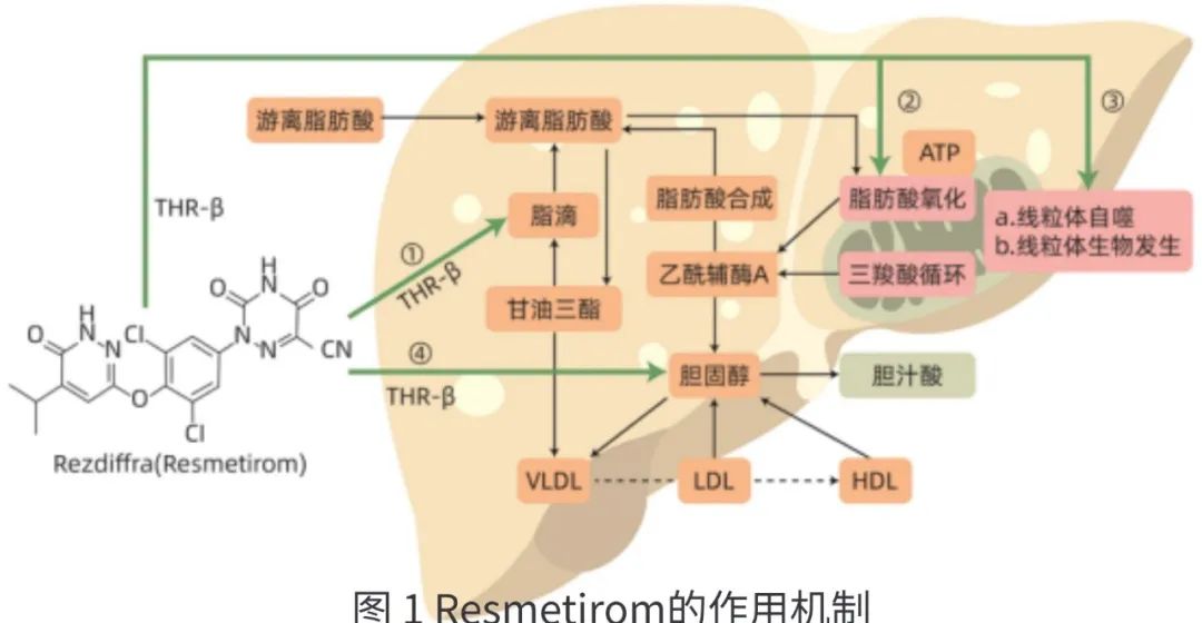 非酒精性脂肪性肝炎(NASH)治疗药物现状与瑞美替罗的突破(图4)