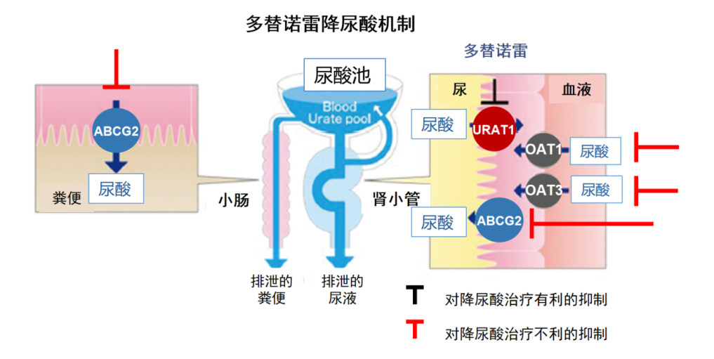 痛风反复发作苦不堪言？多替诺雷为“难治性痛风”带来新选择！(图1)